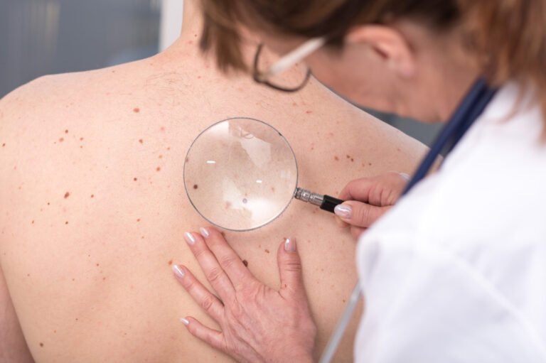 Skin Cancer: Indications and Origins