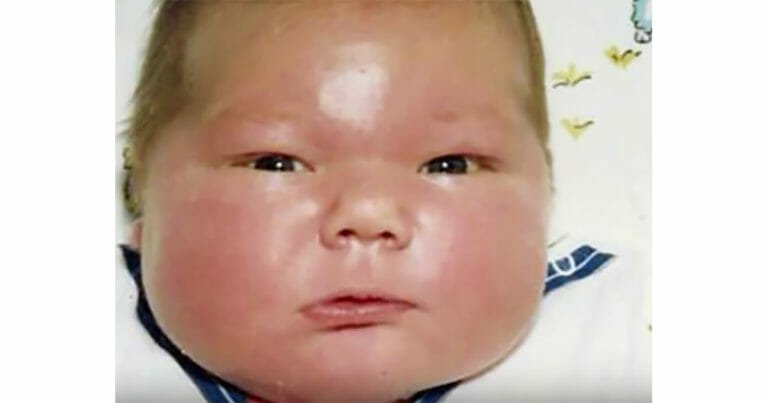 The Remarkable Journey of a Baby Who Weighed 16 Pounds in 1983