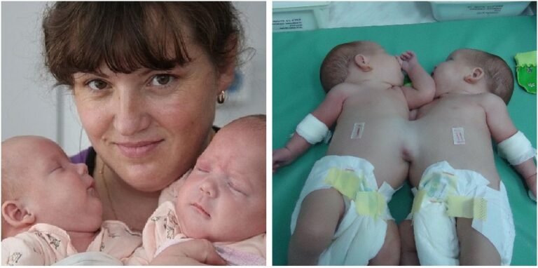 Elena Yachmeneva’s Twin Pregnancy: A Journey of Resilience and Shock